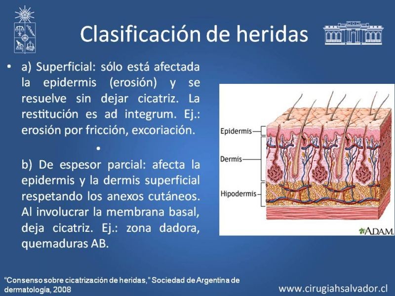 Diapositiva 2 de Curación avanzada de heridas