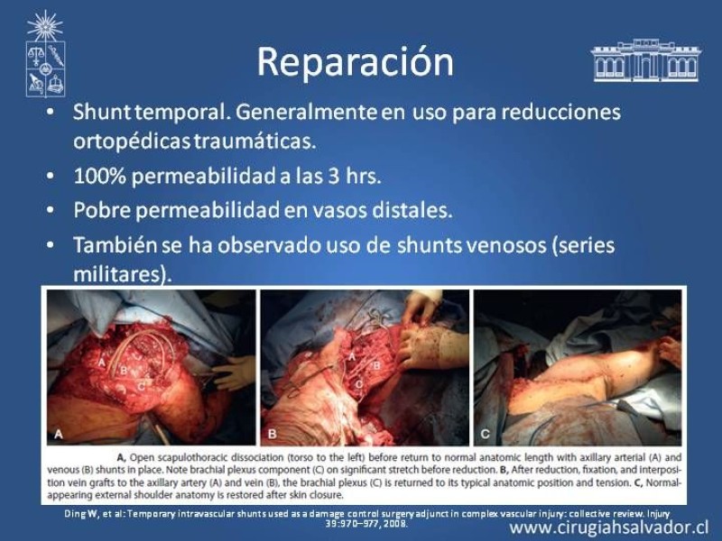 Diapositiva 14 de Trauma Vascular: Extremidades