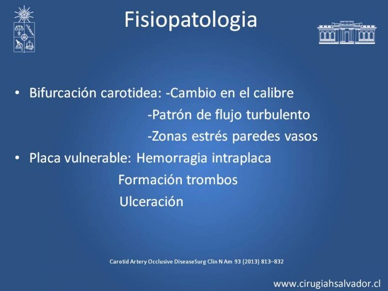 Diapositiva 5 de Estenosis Carotidea