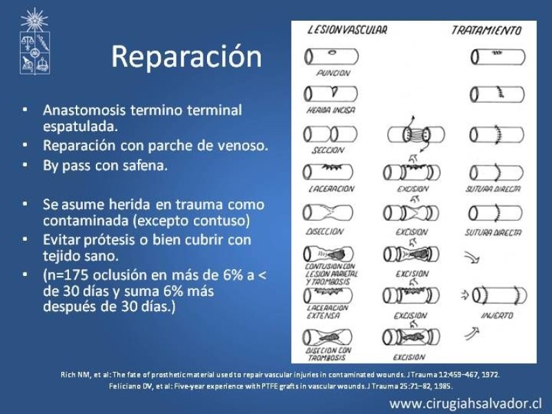 Diapositiva 13 de Trauma Vascular: Extremidades