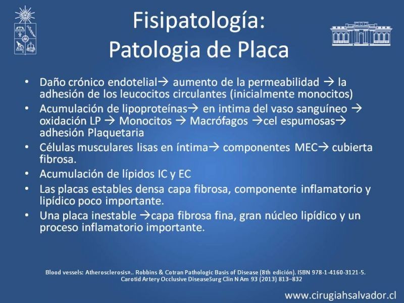Diapositiva 3 de Estenosis Carotidea