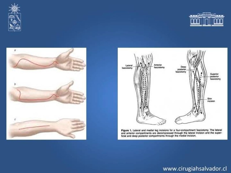 Diapositiva 23 de Trauma Vascular: Extremidades