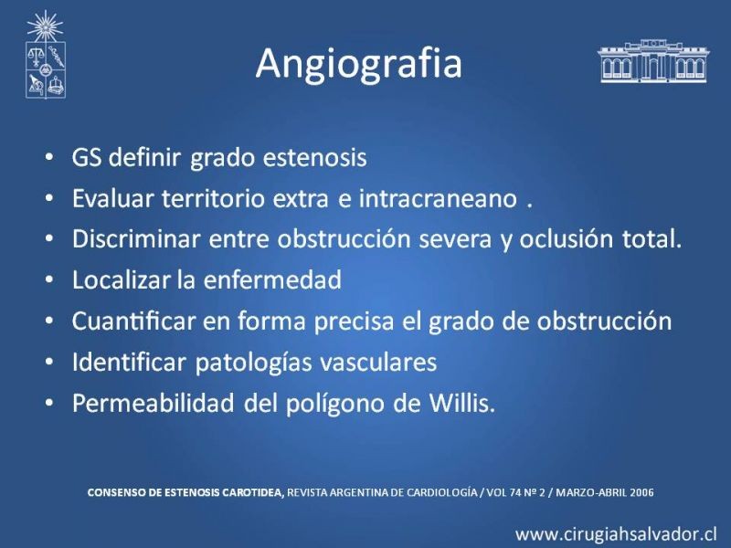 Diapositiva 12 de Estenosis Carotidea