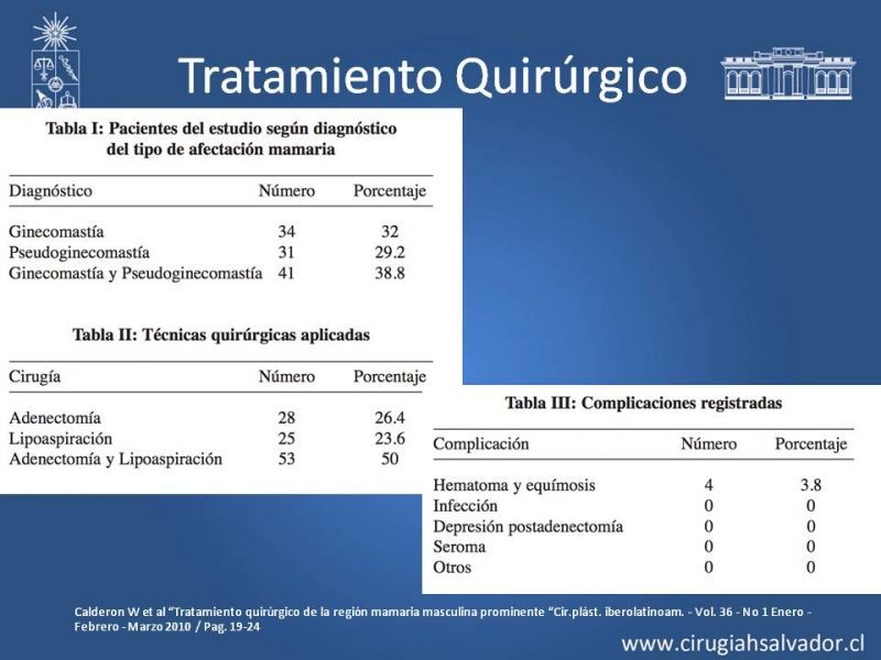 Diapositiva 19 de Ginecomastia