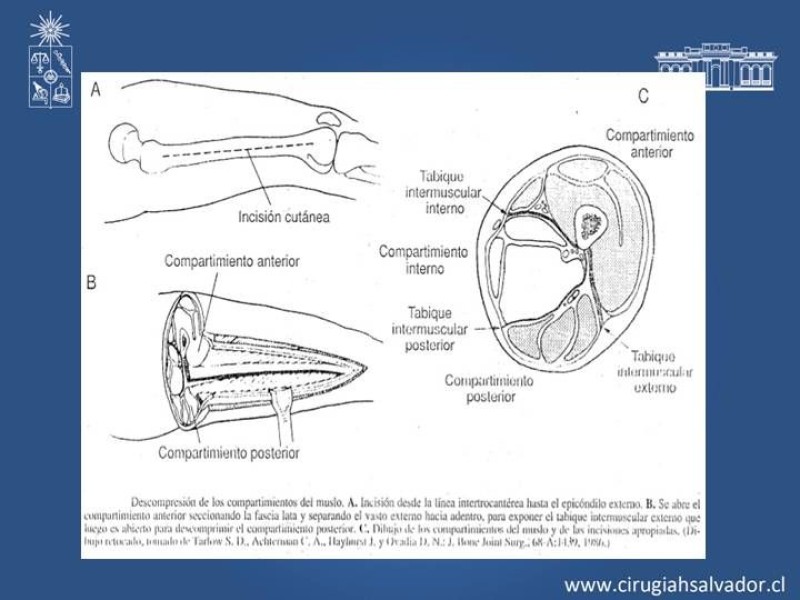 Diapositiva 24 de Trauma Vascular: Extremidades