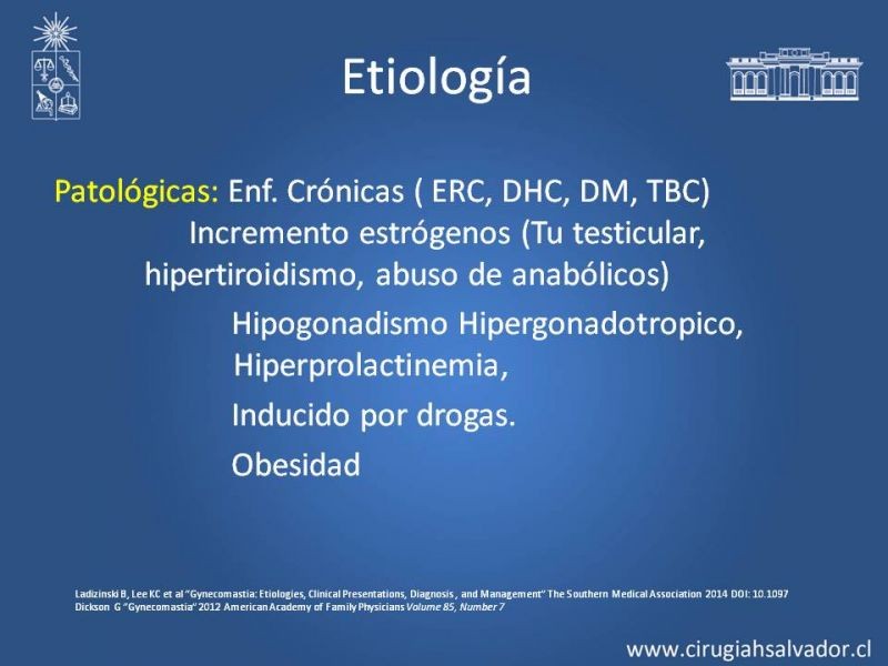 Diapositiva 5 de Ginecomastia