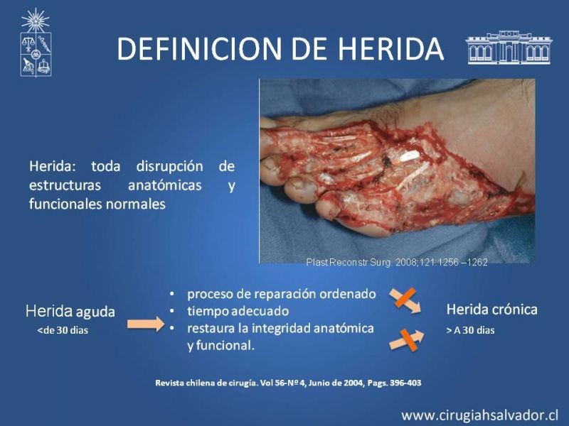 Diapositiva 1 de Curación avanzada de heridas