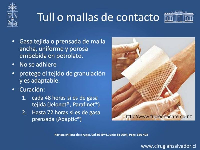 Diapositiva 14 de Curación avanzada de heridas