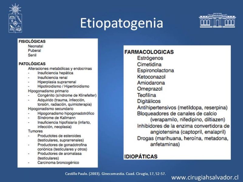 Diapositiva 5 de Ginecomastia