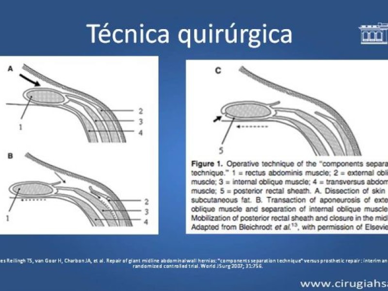 Diapositiva 20 de Separación de componentes