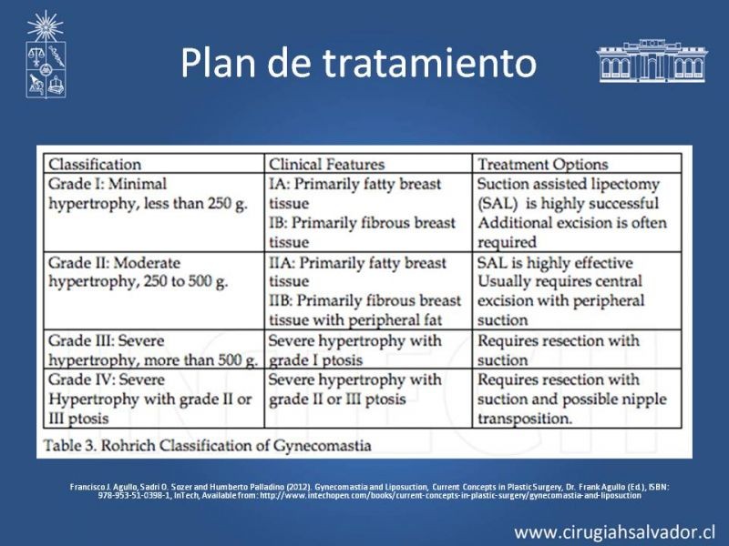 Diapositiva 13 de Ginecomastia