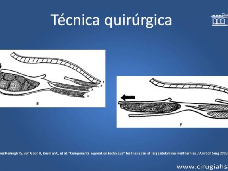 Diapositiva 19 de Separación de componentes