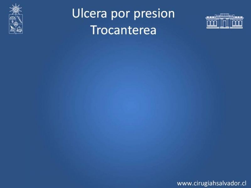 Diapositiva 14 de Manejo quirúrgico de las úlceras por presión