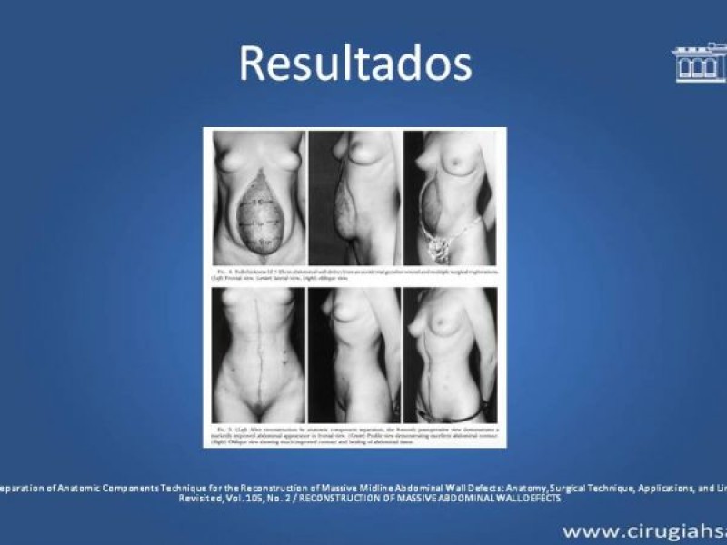 Diapositiva 23 de Separación de componentes