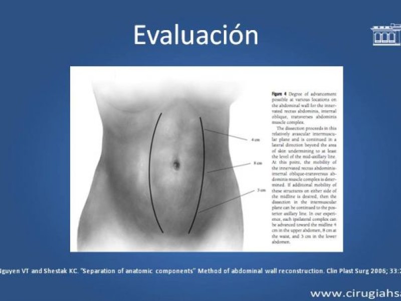 Diapositiva 16 de Separación de componentes