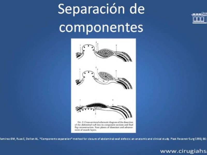 Diapositiva 9 de Separación de componentes