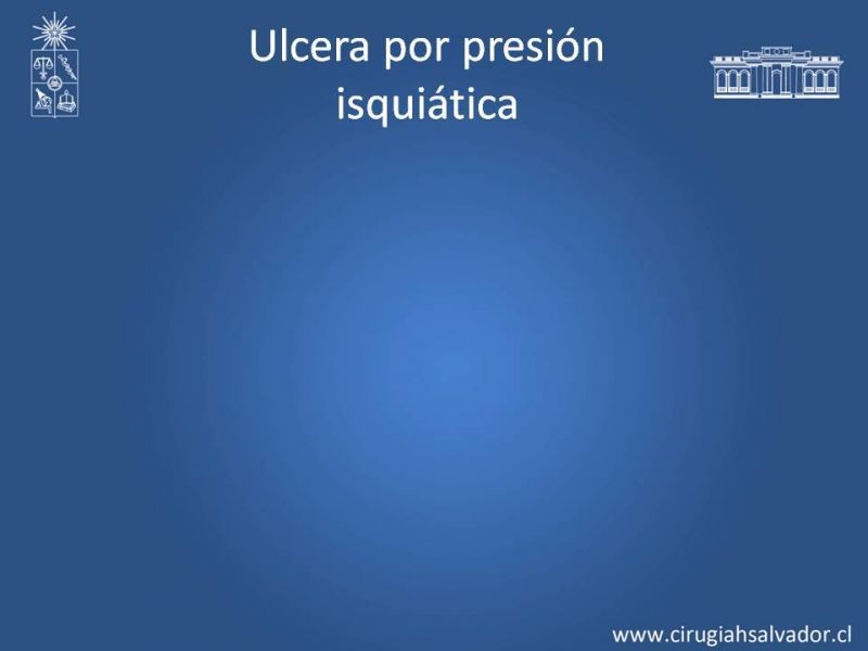 Diapositiva 15 de Manejo quirúrgico de las úlceras por presión