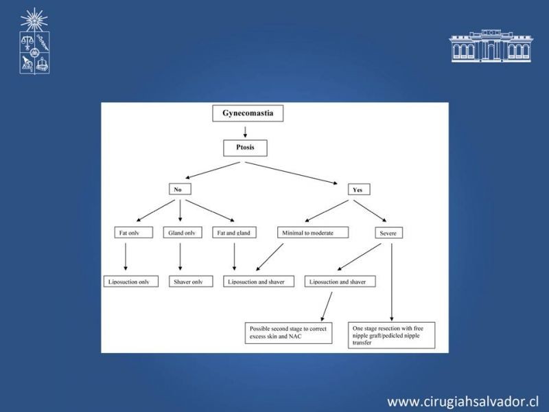 Diapositiva 20 de Ginecomastia