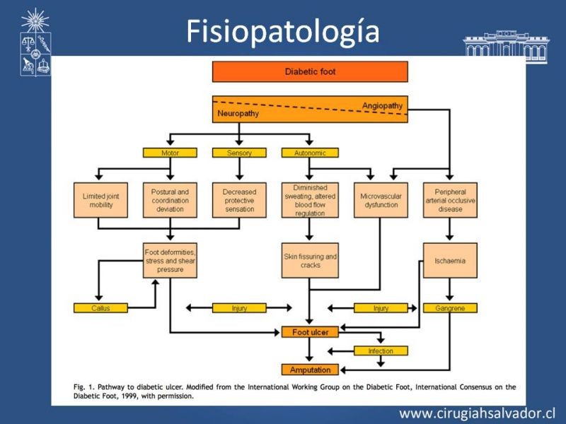 Diapositiva 3 de Pie Diabético