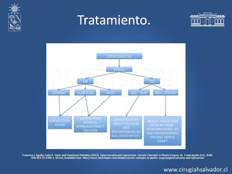 Diapositiva 22 de Ginecomastia