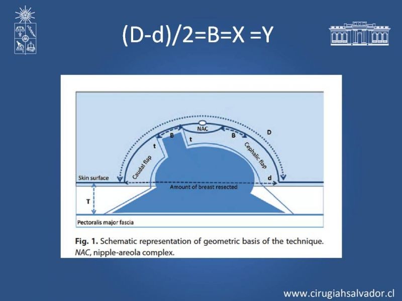 Diapositiva 15 de Ginecomastia