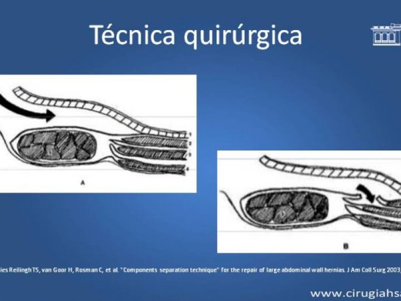 Diapositiva 17 de Separación de componentes