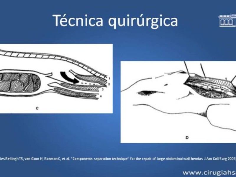 Diapositiva 18 de Separación de componentes