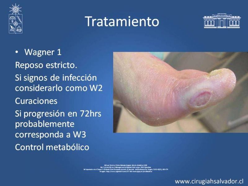 Diapositiva 10 de Pie Diabético