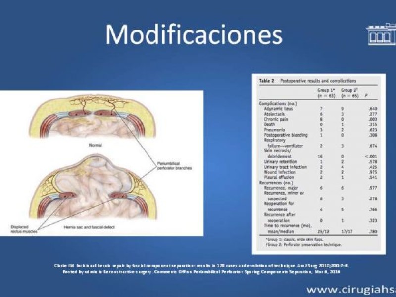 Diapositiva 28 de Separación de componentes