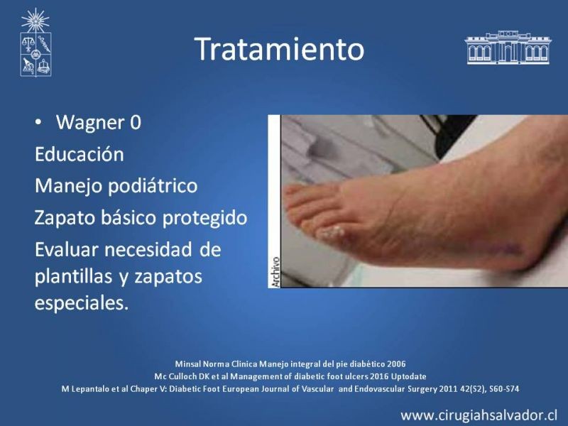 Diapositiva 9 de Pie Diabético