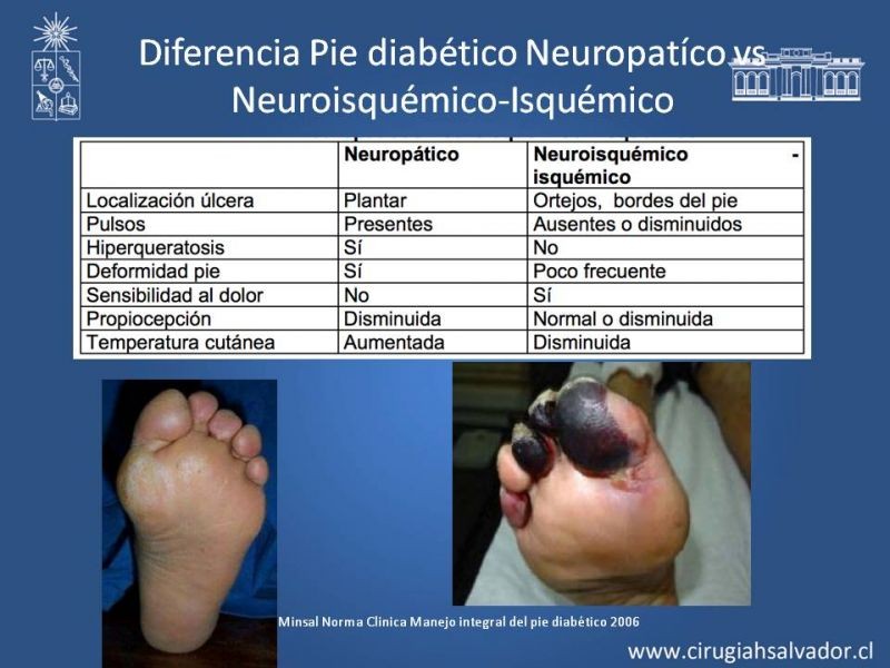 Diapositiva 6 de Pie Diabético