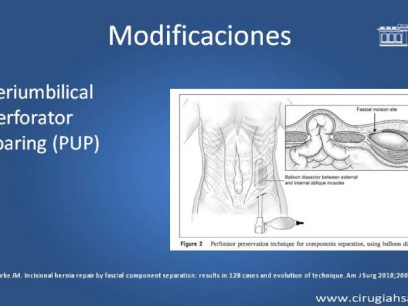 Diapositiva 27 de Separación de componentes