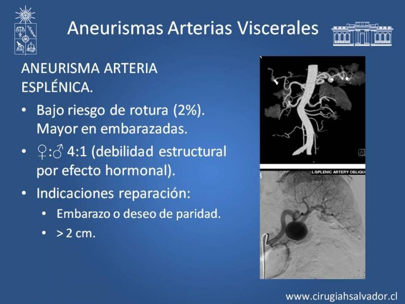 Diapositiva 43 de Aneurismas Periféricos