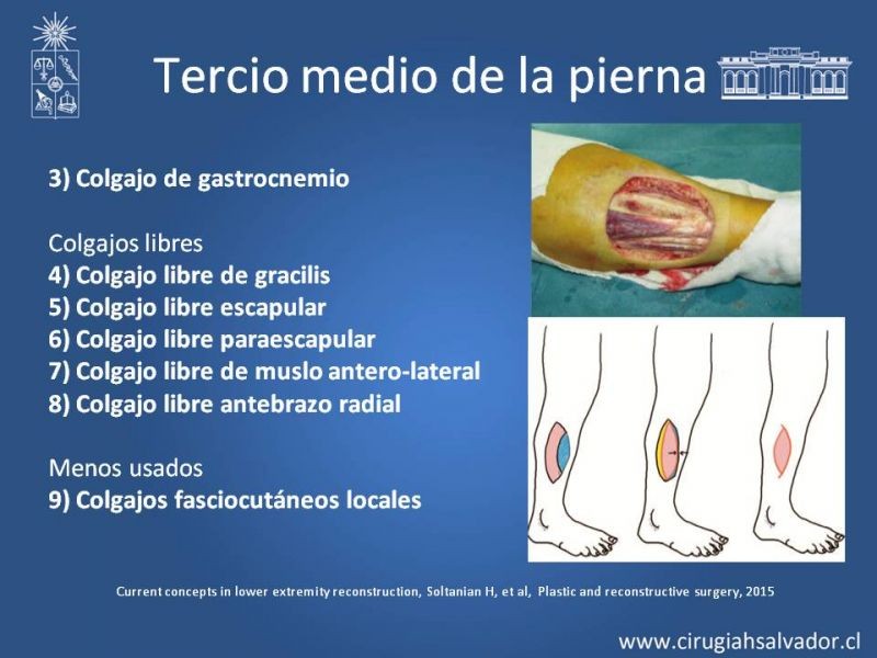Diapositiva 36 de Cobertura miembro inferior