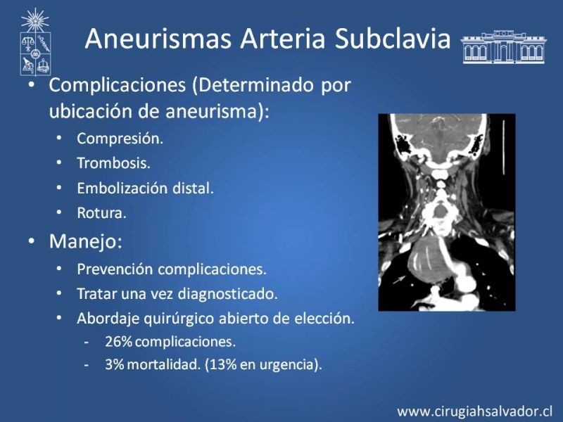 Diapositiva 48 de Aneurismas Periféricos