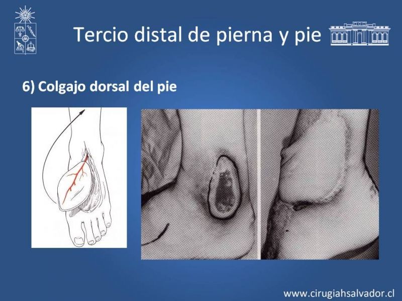 Diapositiva 47 de Cobertura miembro inferior