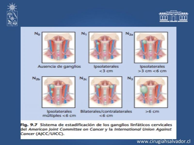 Diapositiva 20 de Metástasis cervical de primario desconocido