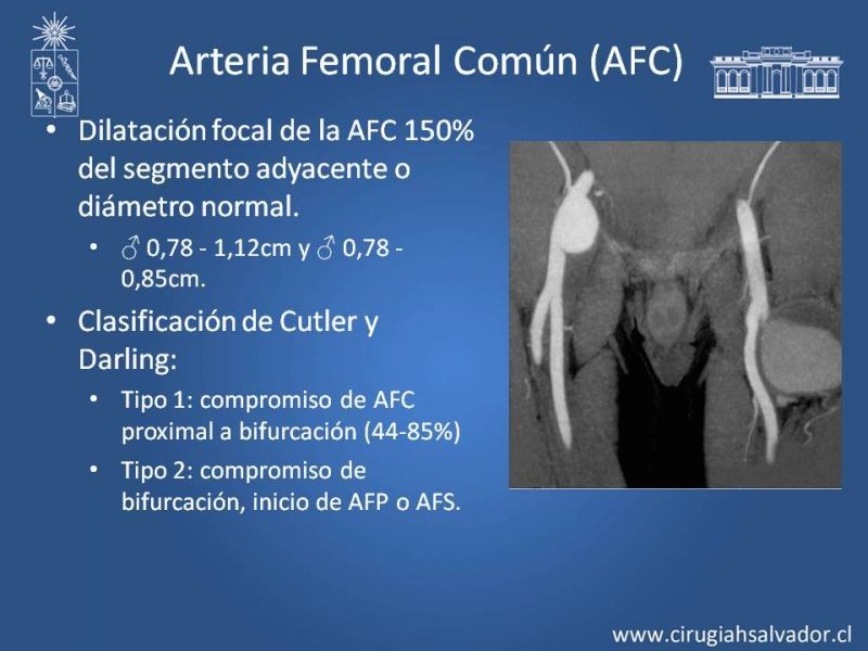 Diapositiva 19 de Aneurismas Periféricos