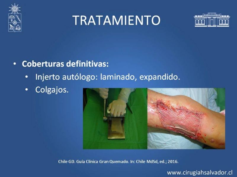 Diapositiva 48 de Gran quemado