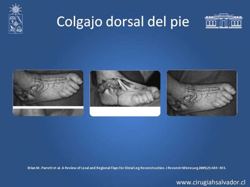 Diapositiva 48 de Cobertura miembro inferior