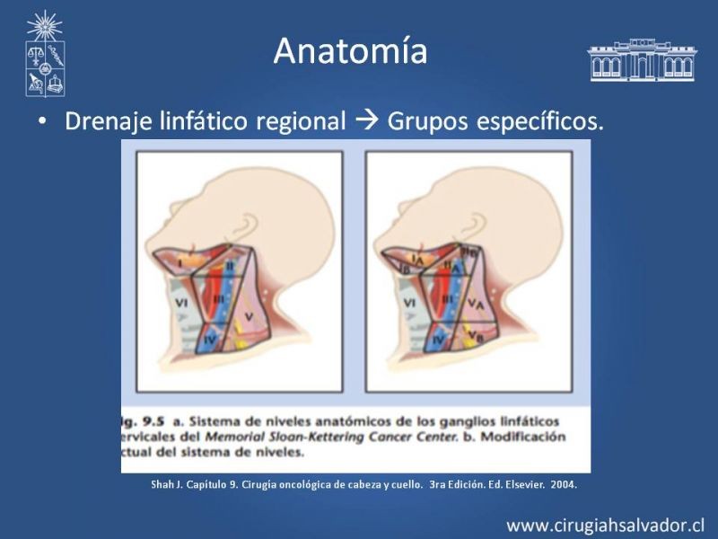 Diapositiva 4 de Metástasis cervical de primario desconocido