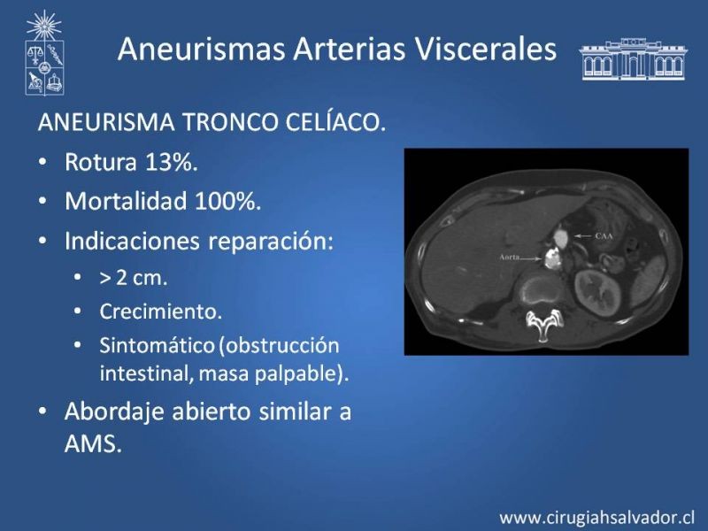 Diapositiva 46 de Aneurismas Periféricos