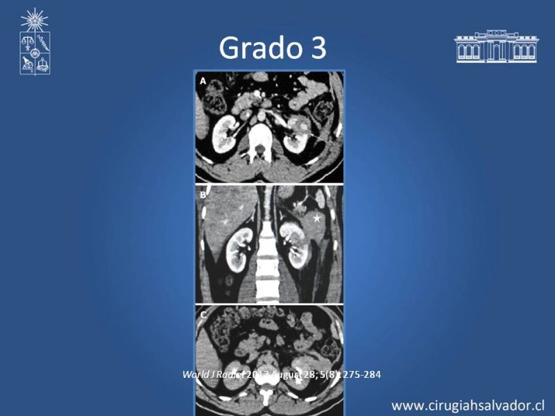Diapositiva 10 de Lesiones de vía urinaria
