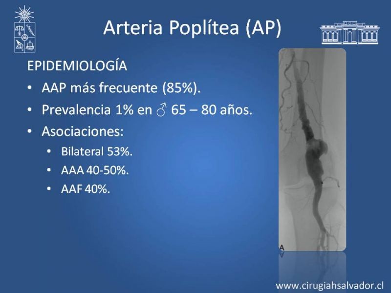 Diapositiva 6 de Aneurismas Periféricos