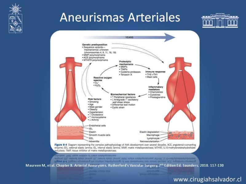 Diapositiva 3 de Aneurismas Periféricos