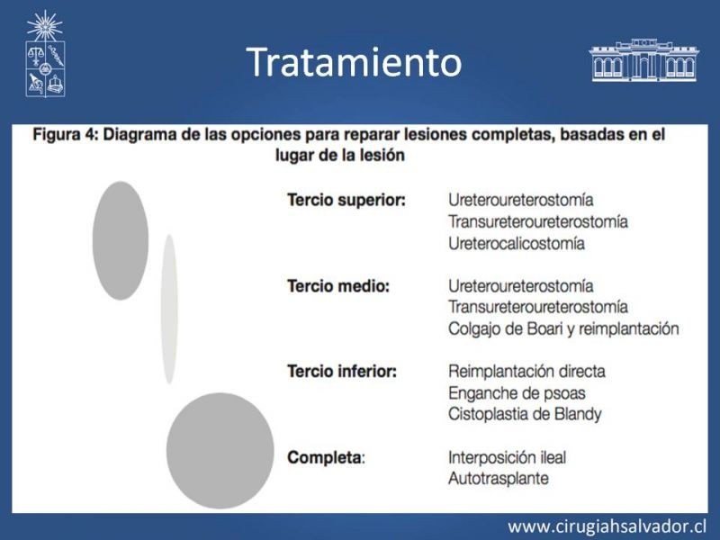 Diapositiva 26 de Lesiones de vía urinaria