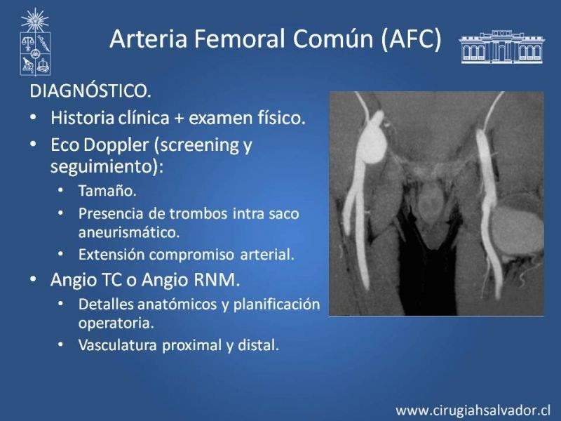 Diapositiva 22 de Aneurismas Periféricos