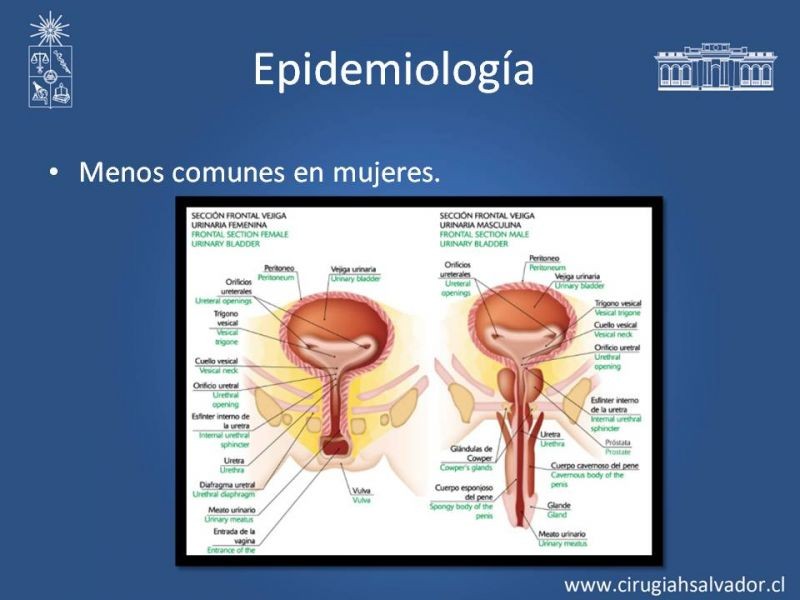 Diapositiva 4 de Trauma Uretral