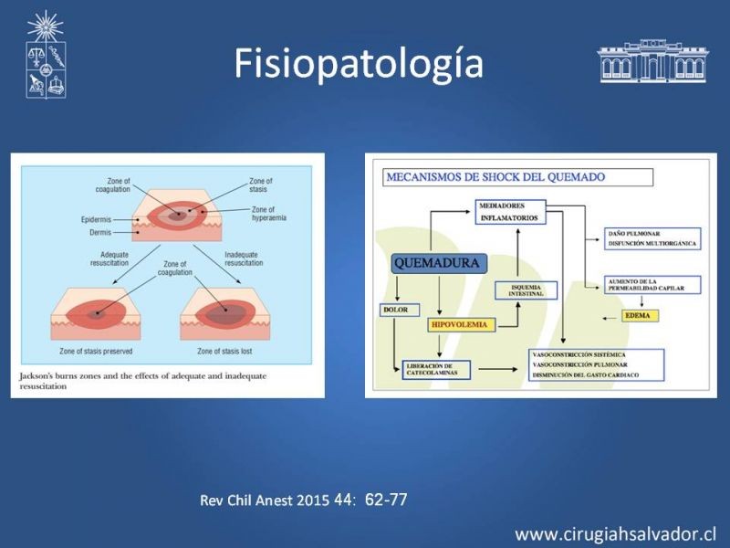 Diapositiva 9 de Manejo Médico del Gran Quemado