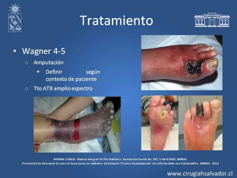 Diapositiva 22 de Pie Diabético